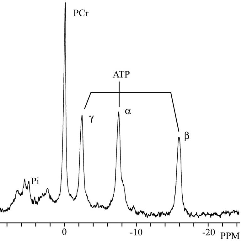 31P Spectrum