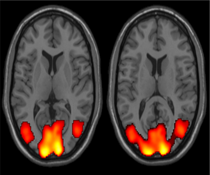 Activation of visual cortex